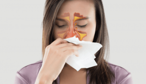 Inflamarea sinusurilor