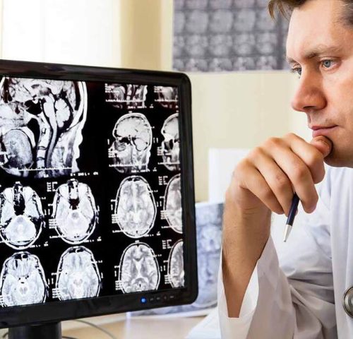 neurologie-si-neurochirurgie2